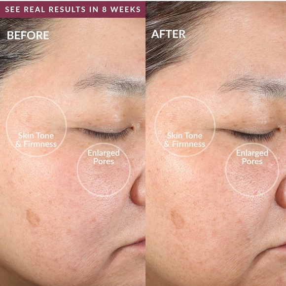 NIB PMD Clean - Smart Facial Cleansing Device with Silicone Brush & Massager - Picture 10 of 12